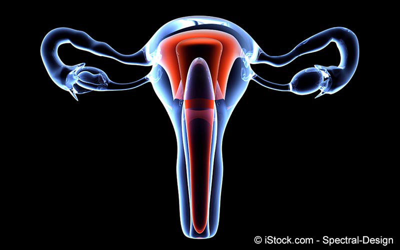 Lange dauert gebärmutterentfernung eine prodiftusu: wie Hysterektomie: Ablauf