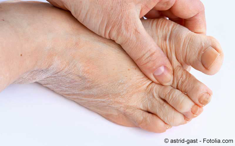 Stechende Schmerzen Nach Hallux Op Captions Hunter
