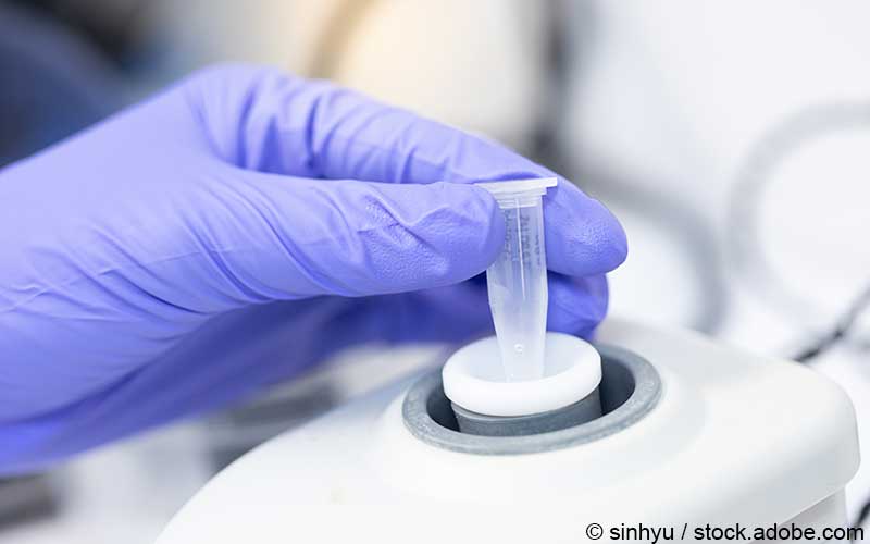 Polymerase Kettenreaktion Polymerase Kettenreaktion