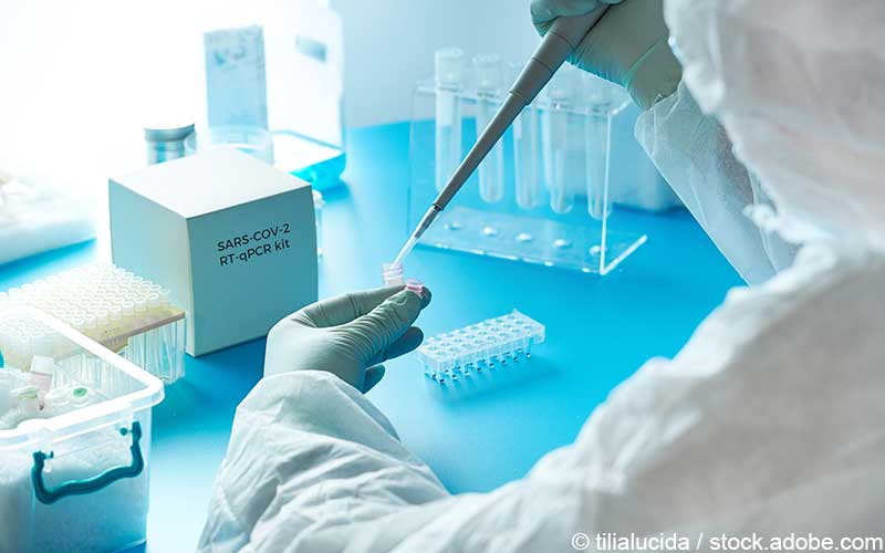 Sars-CoV2 Testkit Sars-CoV2 Testkit